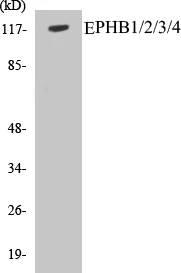 EPHB1 + 2 + 3 + 4 Cell Based ELISA Kit (A103361-96)