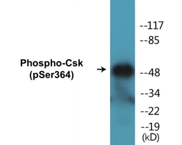 Csk (phospho Ser364) Cell Based ELISA Kit (A102390-296)