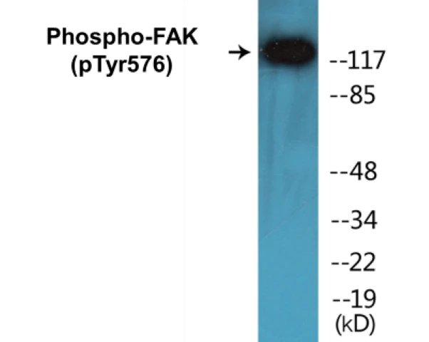 FAK (phospho Tyr576) Cell Based ELISA Kit (A102416-296)