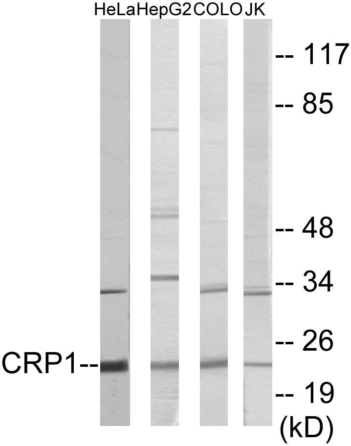 CRP1 Cell Based ELISA Kit (A103276-96)