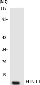 HINT1 Cell Based ELISA Kit (A103148-96)