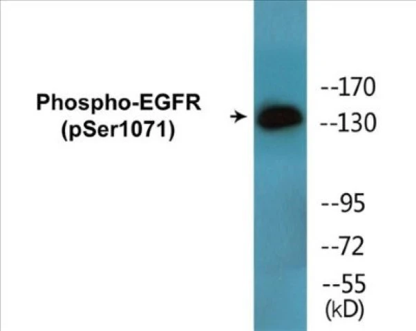 EGFR (phospho Ser1071) Cell Based ELISA Kit (A102212-296)