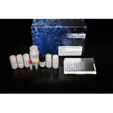 Human Cathepsin V ELISA Kit (A103869-96)