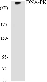 DNA-PK Cell Based ELISA Kit (A103408-96)