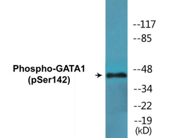 GATA1 (phospho Ser142) Cell Based ELISA Kit (A102200-296)