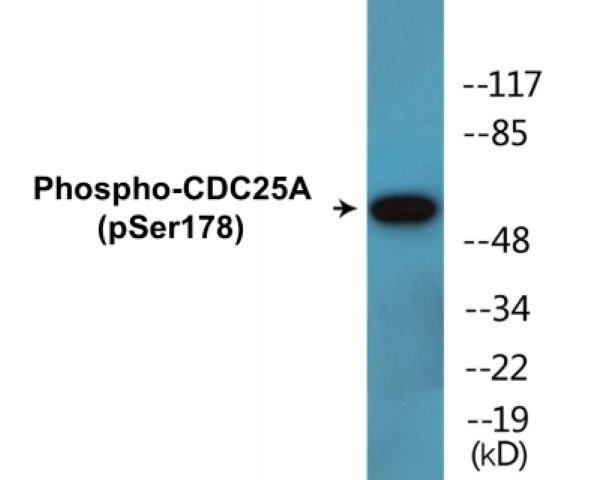 CDC25A (phospho Ser178) Cell Based ELISA Kit (A102079-296)