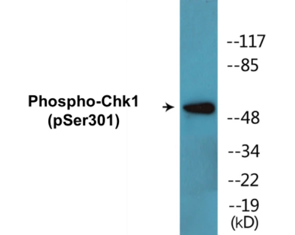 Chk1 (phospho Ser301) Cell Based ELISA Kit (A102277-296)