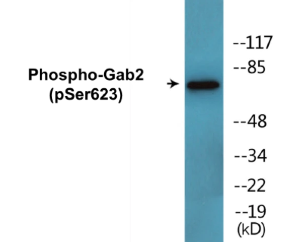 Gab2 (phospho Ser623) Cell Based ELISA Kit (A102356-296)