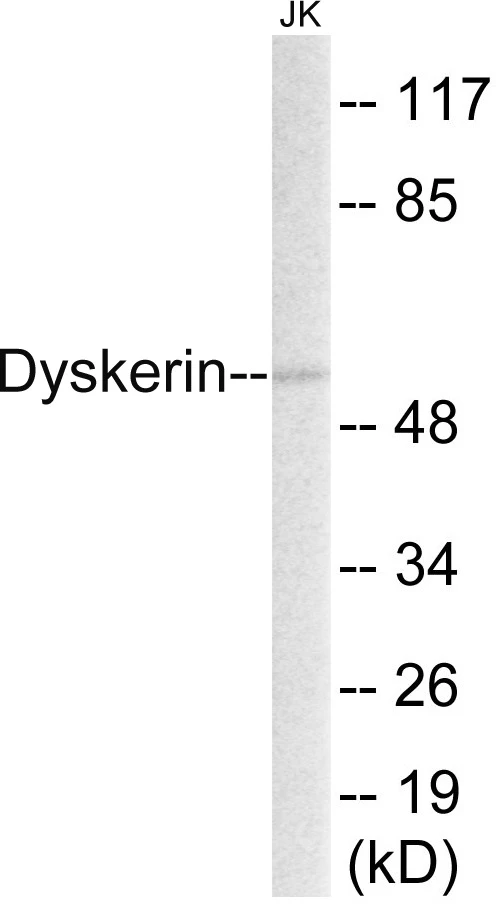 Dyskerin Cell Based ELISA Kit (A102965-96)