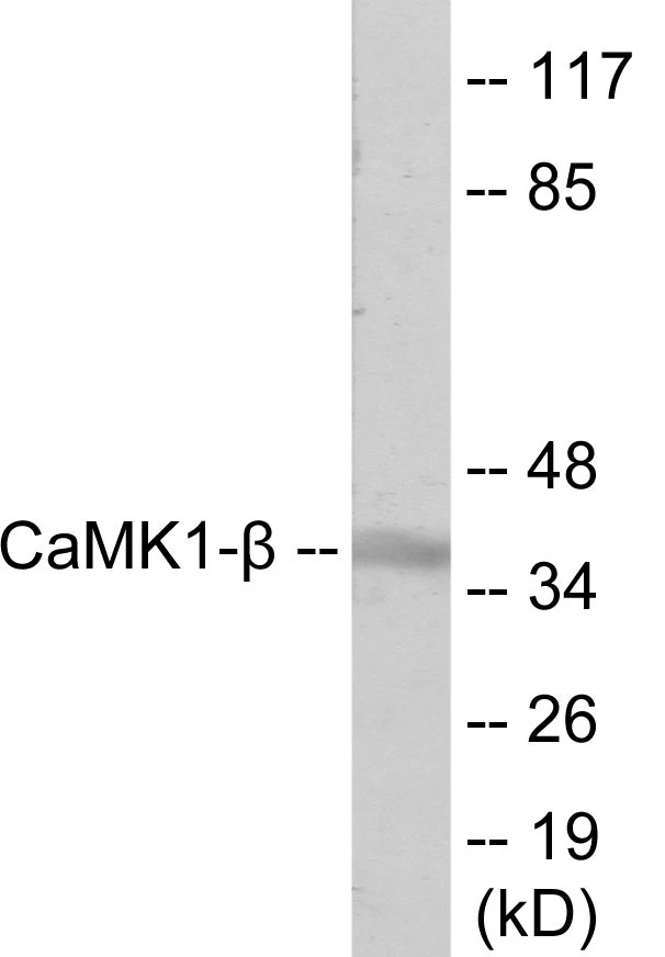 CaMK1 beta Cell Based ELISA Kit (A102904-96)