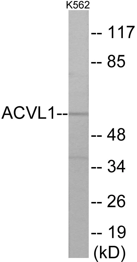 ACVL1 Cell Based ELISA Kit (A103075-96)