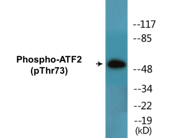 ATF2 (phospho Thr73) Cell Based ELISA Kit (A102435-296)