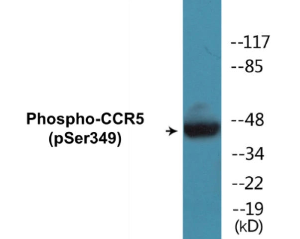 CCR5 (phospho Ser349) Cell Based ELISA Kit (A102731-296)