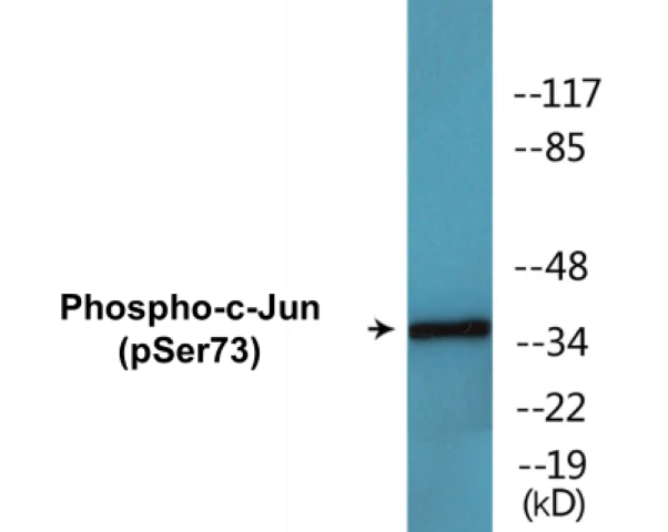 c-Jun (phospho Ser73) Cell Based ELISA Kit (A102329-296)