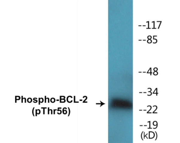 BCL-2 (phospho Thr56) Cell Based ELISA Kit (A102740-296)