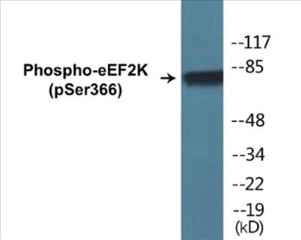 eEF2K (phospho Ser366) Cell Based ELISA Kit (A102696-296)