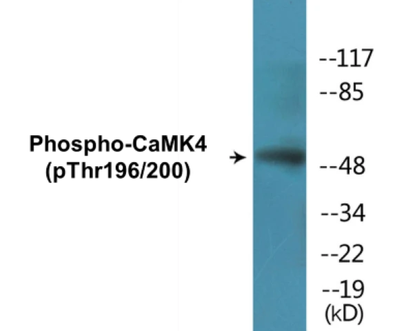 CaMK4 (phospho Thr196 + Thr200) Cell Based ELISA Kit (A102376-296)