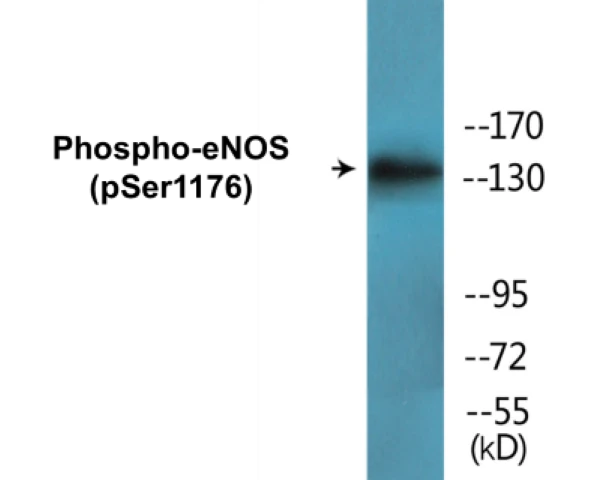 eNOS (phospho Ser1176) Cell Based ELISA Kit (A103790-296)