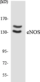 eNOS Cell Based ELISA Kit (A103209-96)