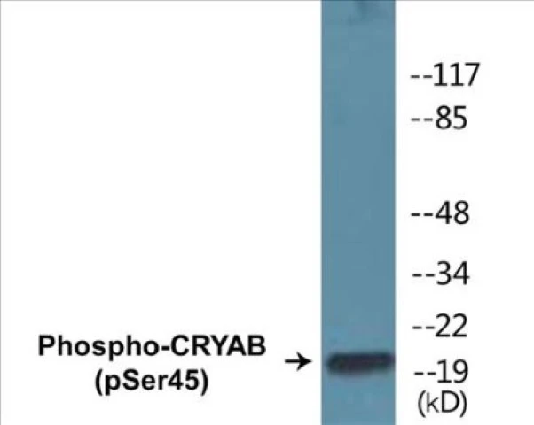 CRYAB (phospho Ser45) Cell Based ELISA Kit (A102313-296)