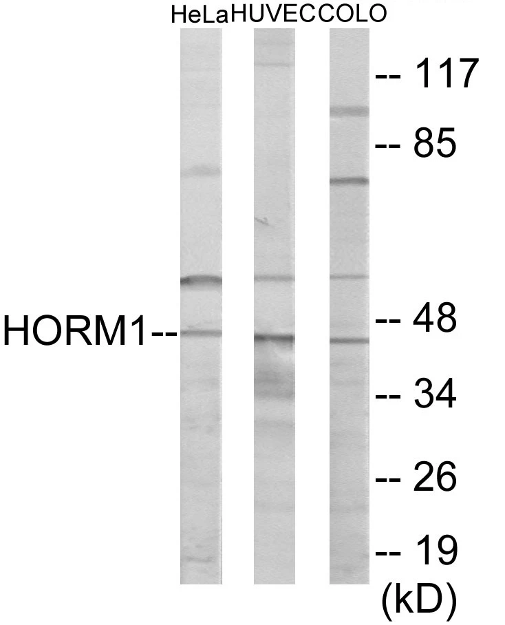 HORMAD1 Cell Based ELISA Kit (A103642-96)