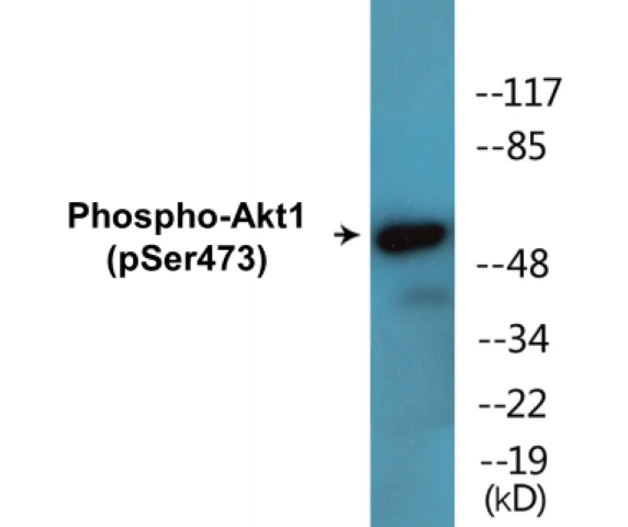 Akt1 (phospho Ser473) Cell Based ELISA Kit (A103812-296)