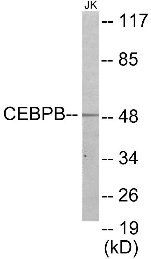 CEBPB Cell Based ELISA Kit (A103470-96)