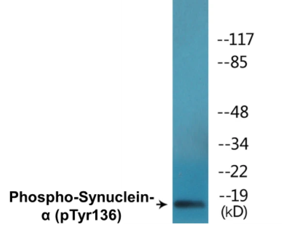 alpha Synuclein (phospho Tyr136) Cell Based ELISA Kit (A102245-296)