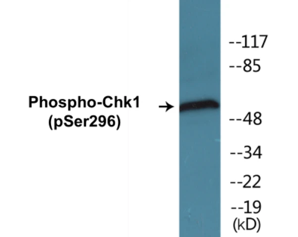 Chk1 (phospho Ser296) Cell Based ELISA Kit (A102728-296)