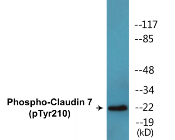 Claudin 7 (phospho Tyr210) Cell Based ELISA Kit (A102566-296)