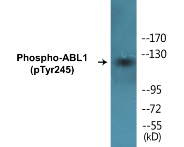 ABL1 (phospho Tyr245) Cell Based ELISA Kit (A103811-296)