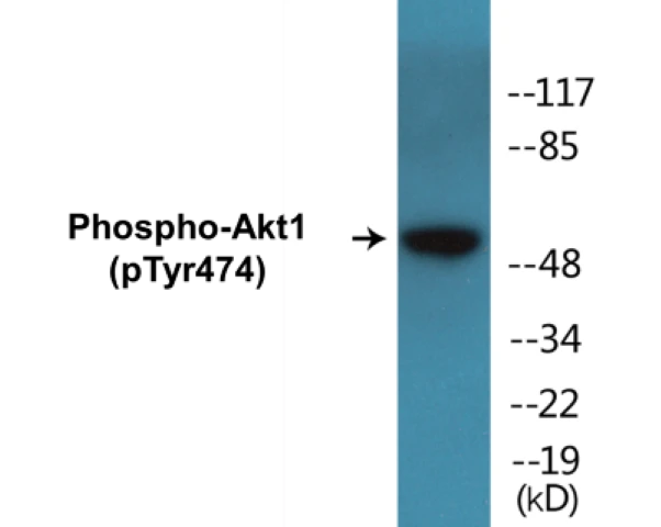 Akt1 (phospho Tyr474) Cell Based ELISA Kit (A102299-296)