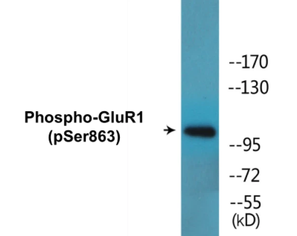 GluR1 (phospho Ser863) Cell Based ELISA Kit (A102137-296)