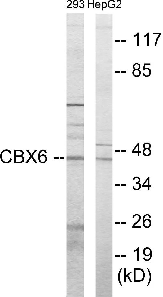 CBX6 Cell Based ELISA Kit (A103271-96)