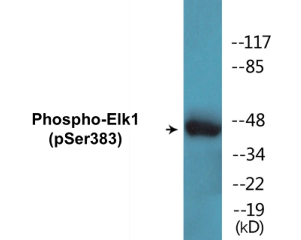 Elk1 (phospho Ser383) Cell Based ELISA Kit (A102332-296)