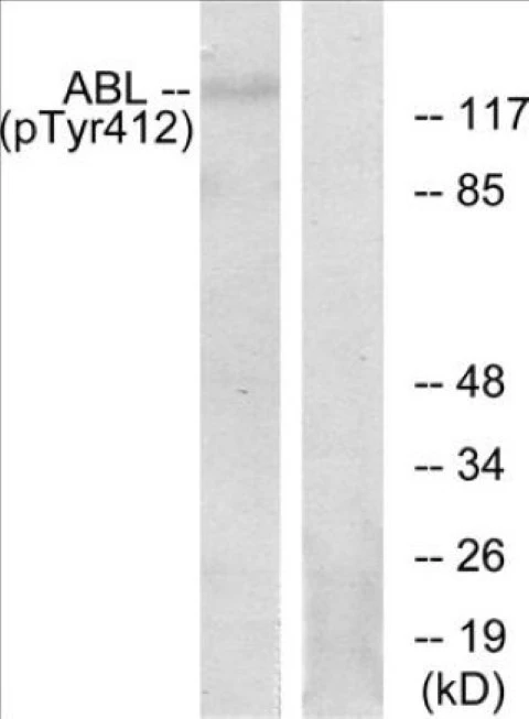 Abl (phospho Tyr393 + Tyr412) Cell Based ELISA Kit (A102682-296)