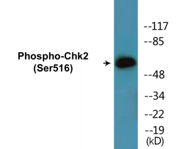 Chk2 (phospho Ser516) Cell Based ELISA Kit (A102742-296)