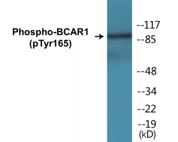 BCAR1 (phospho Tyr165) Cell Based ELISA Kit (A102155-296)