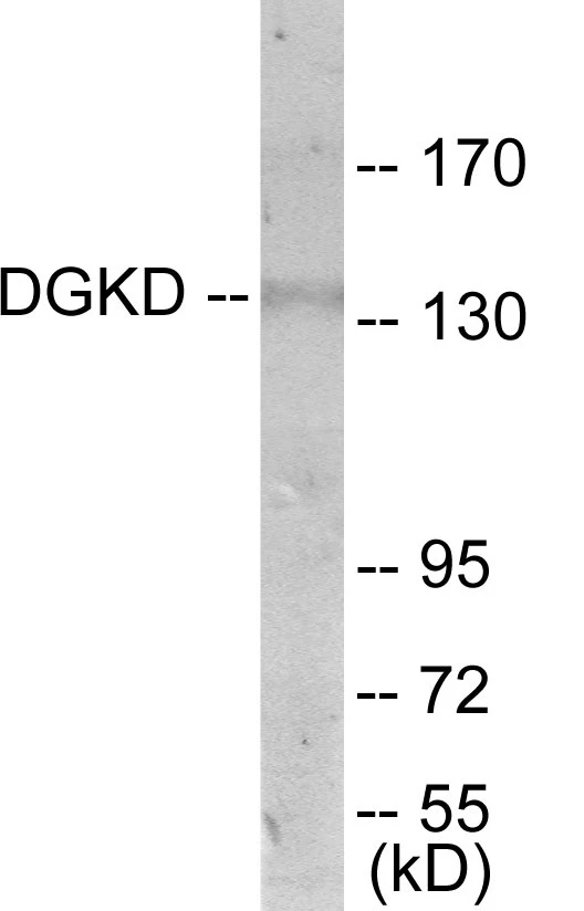 DGKD Cell Based ELISA Kit (A103739-96)