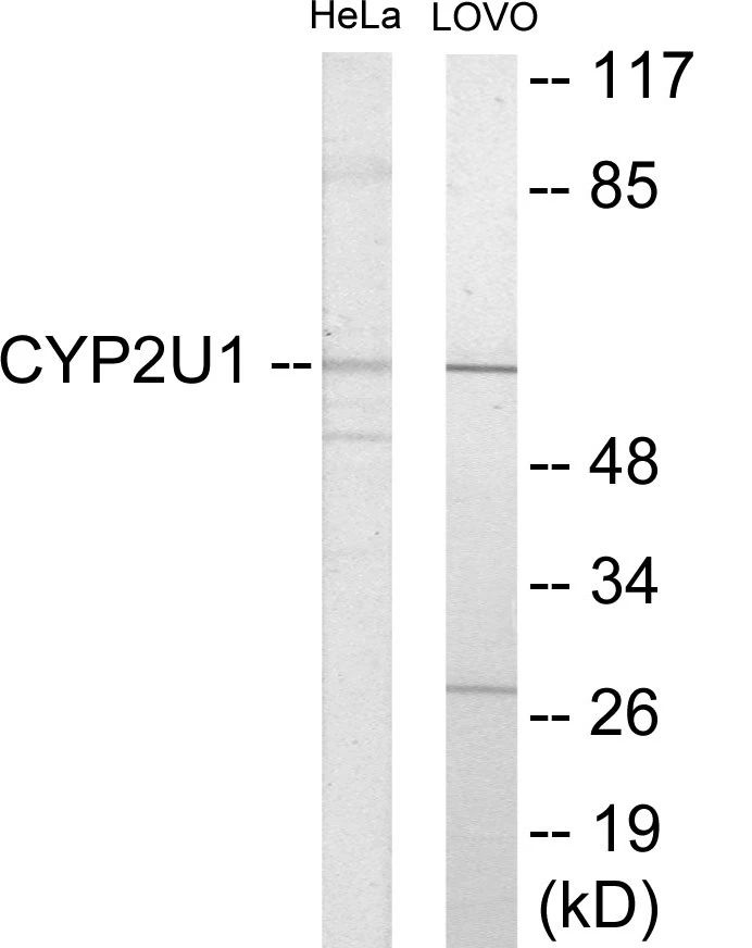 Cytochrome P45 02U1 Cell Based ELISA Kit (A102810-96)