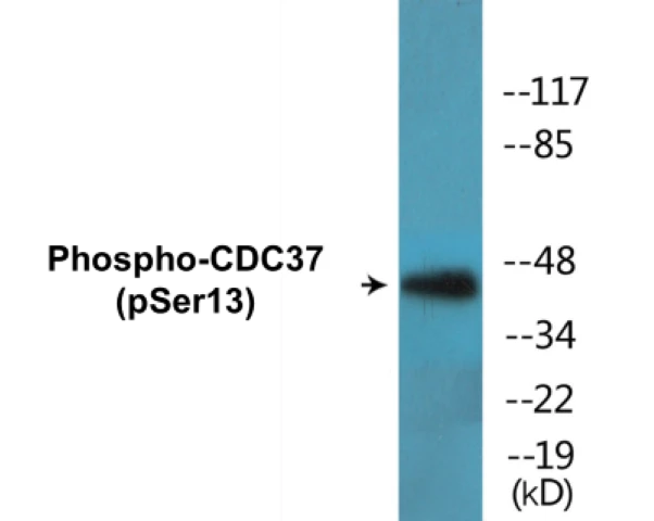 CDC37 (phospho Ser13) Cell Based ELISA Kit (A102316-296)