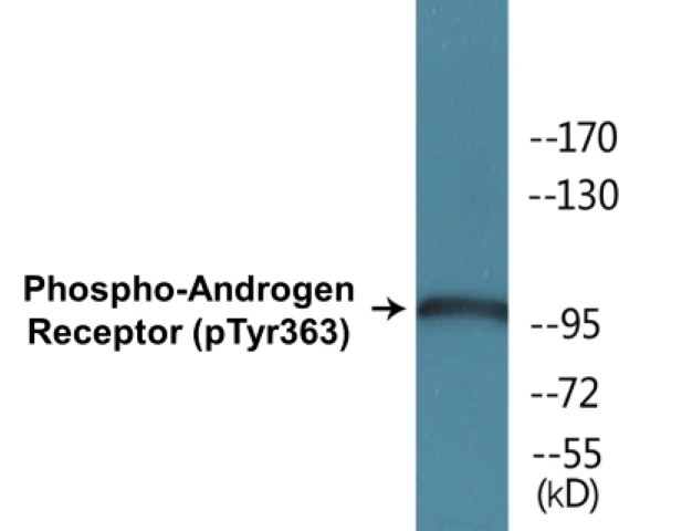 Androgen Receptor (phospho Tyr363) Cell Based ELISA Kit (A103760-296)