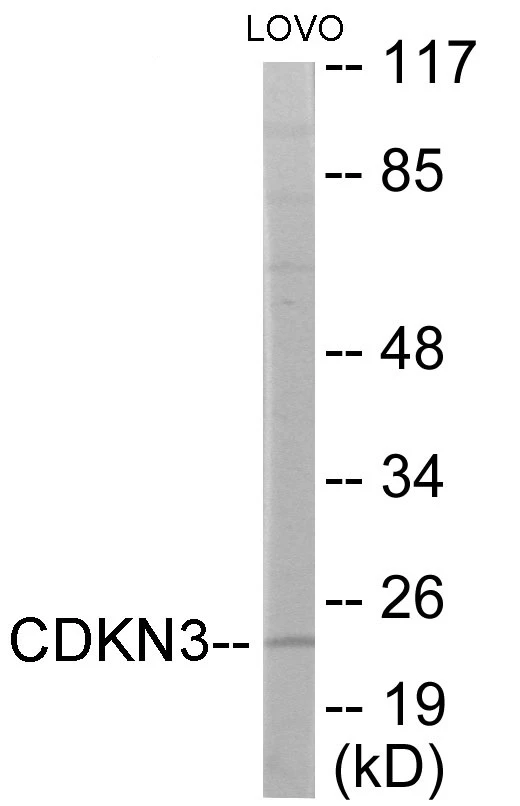 CDKN3 Cell Based ELISA Kit (A103479-96)