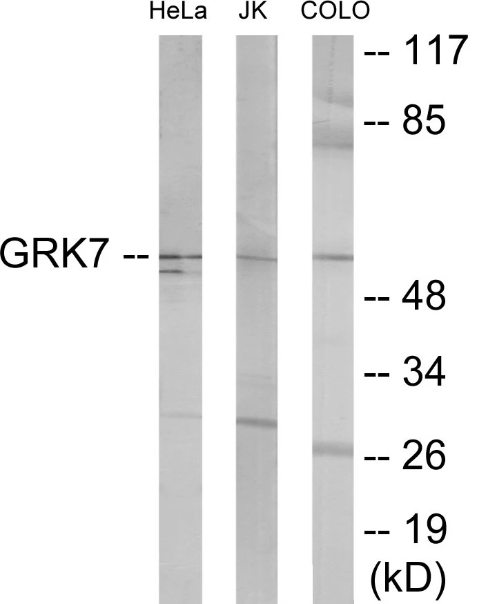 GRK7 Cell Based ELISA Kit (A103717-96)