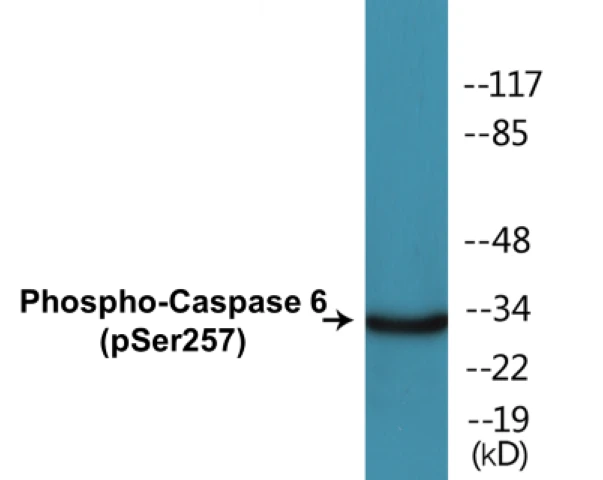 Caspase 6 (phospho Ser257) Cell Based ELISA Kit (A102535-296)