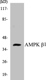 AMPK beta 1 Cell Based ELISA Kit (A102867-96)