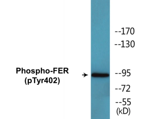 FER (phospho Tyr402) Cell Based ELISA Kit (A102665-296)