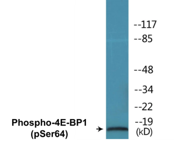 4E-BP1 (phospho Ser64) Cell Based ELISA Kit (A102168-296)