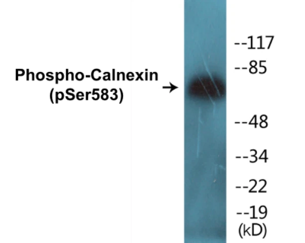 Calnexin (phospho Ser583) Cell Based ELISA Kit (A102575-296)