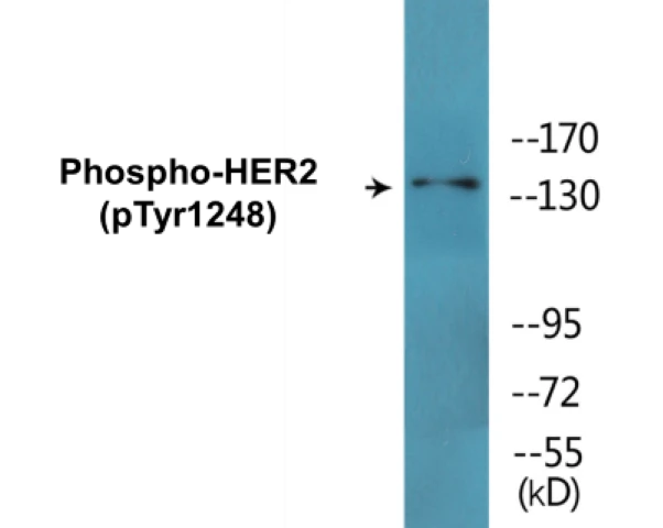 HER2 (phospho Tyr1248) Cell Based ELISA Kit (A103792-296)